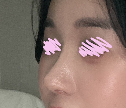 수술후_2_.jpg