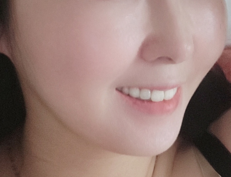 더 빨리할걸 그랬어요 고민왜했지