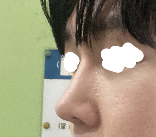수술후_2_-1.jpg