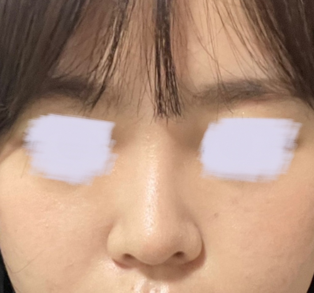 자연스럽게+이쁘게 된 코ㅎㅎ 아주우우우만족!