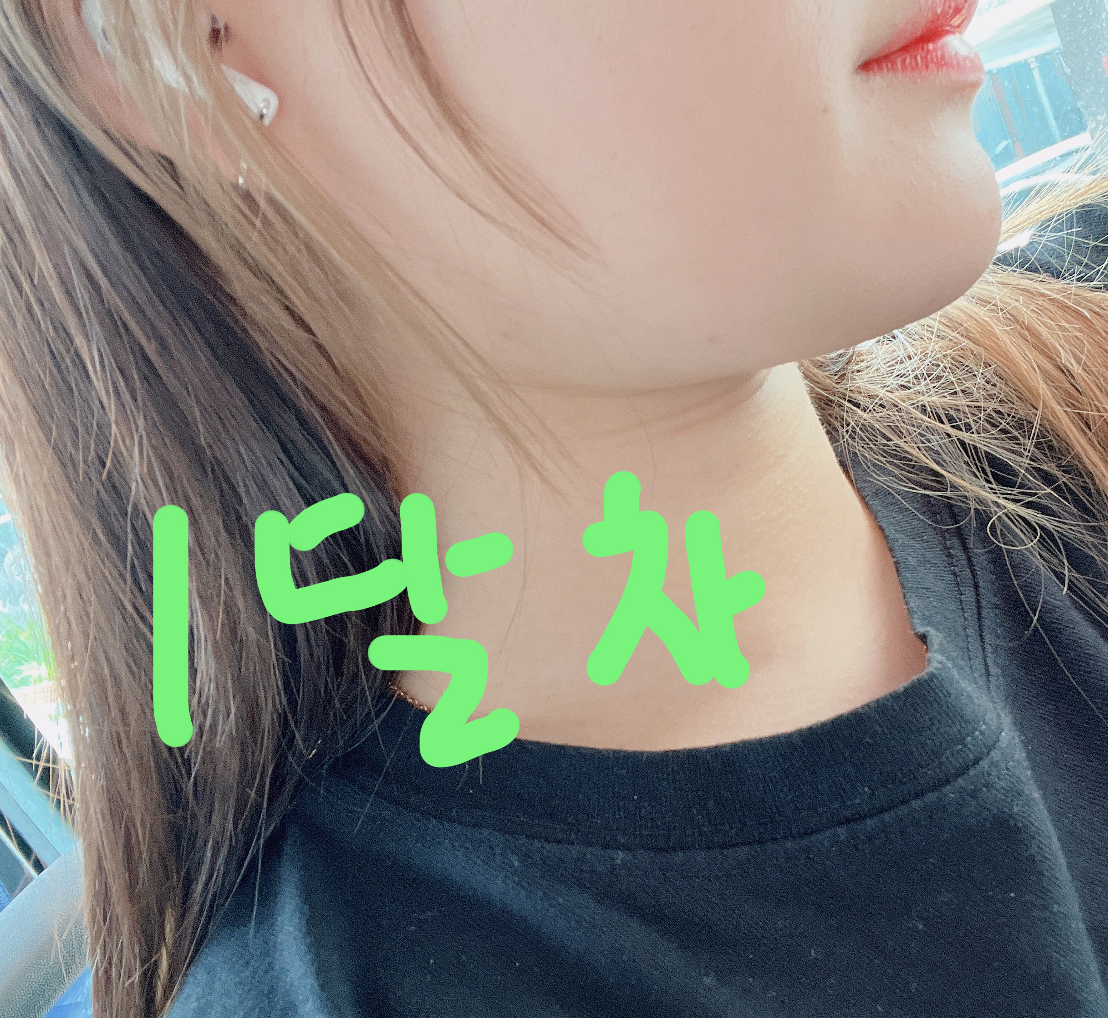 지방흡입받고 새로 태어난 기분이에용ㅋㅋ