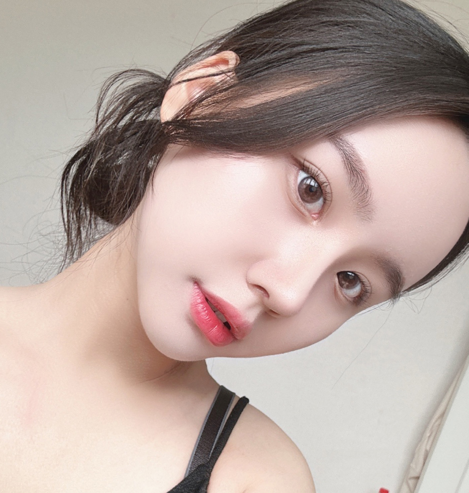 코성형1개월차! 상담부터 수술, 사후관리까지 만족:)