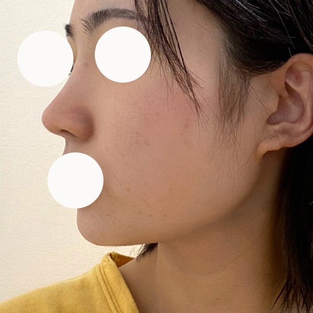 코 얼굴지흡 모두 넘넘 만족중입니다