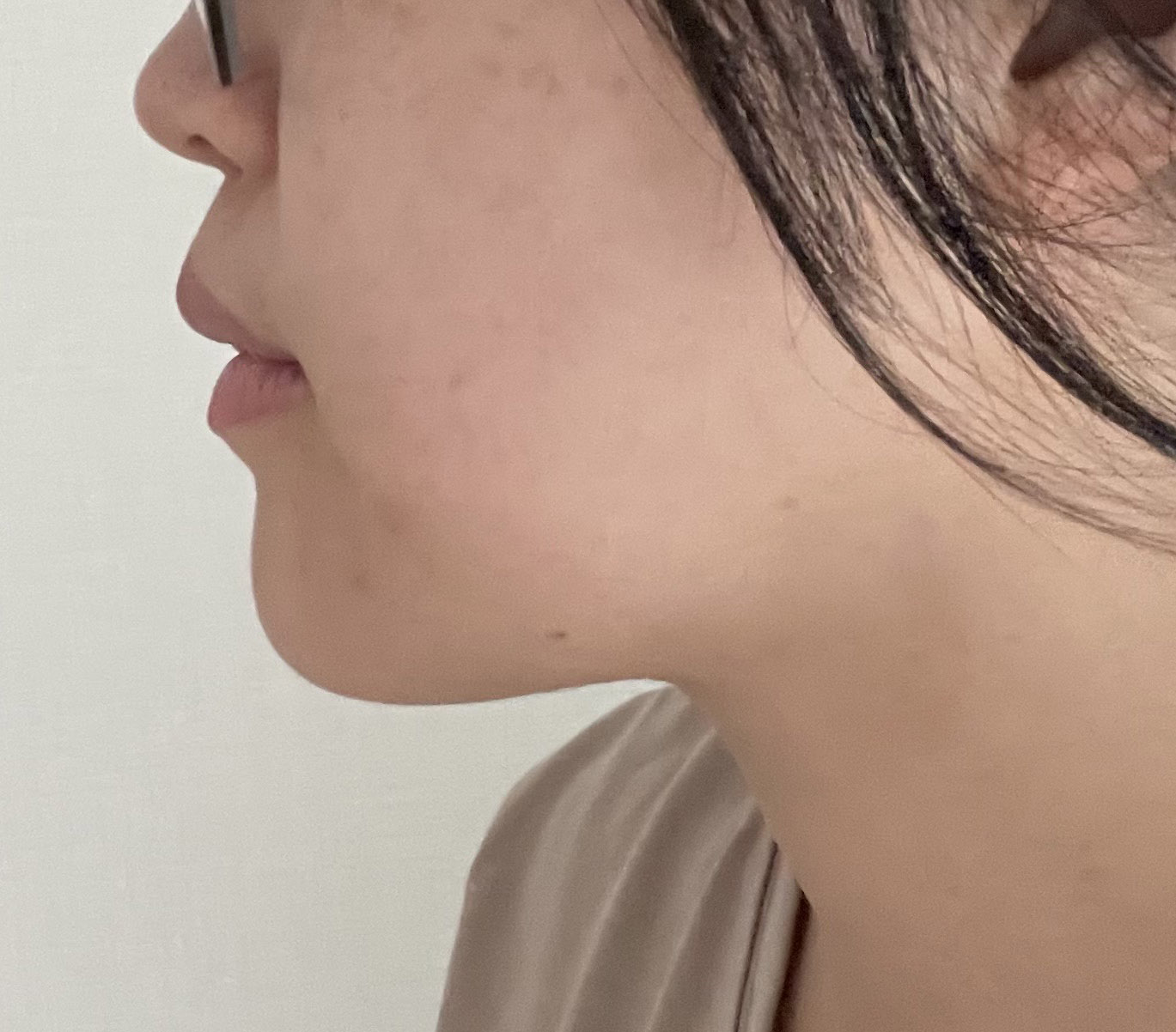 이중턱 없어지니까 너무 좋습니닷!!