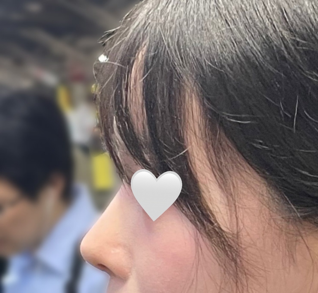 카리나 같은 코 원했는데 만족 ㅠ_ㅠ!!!