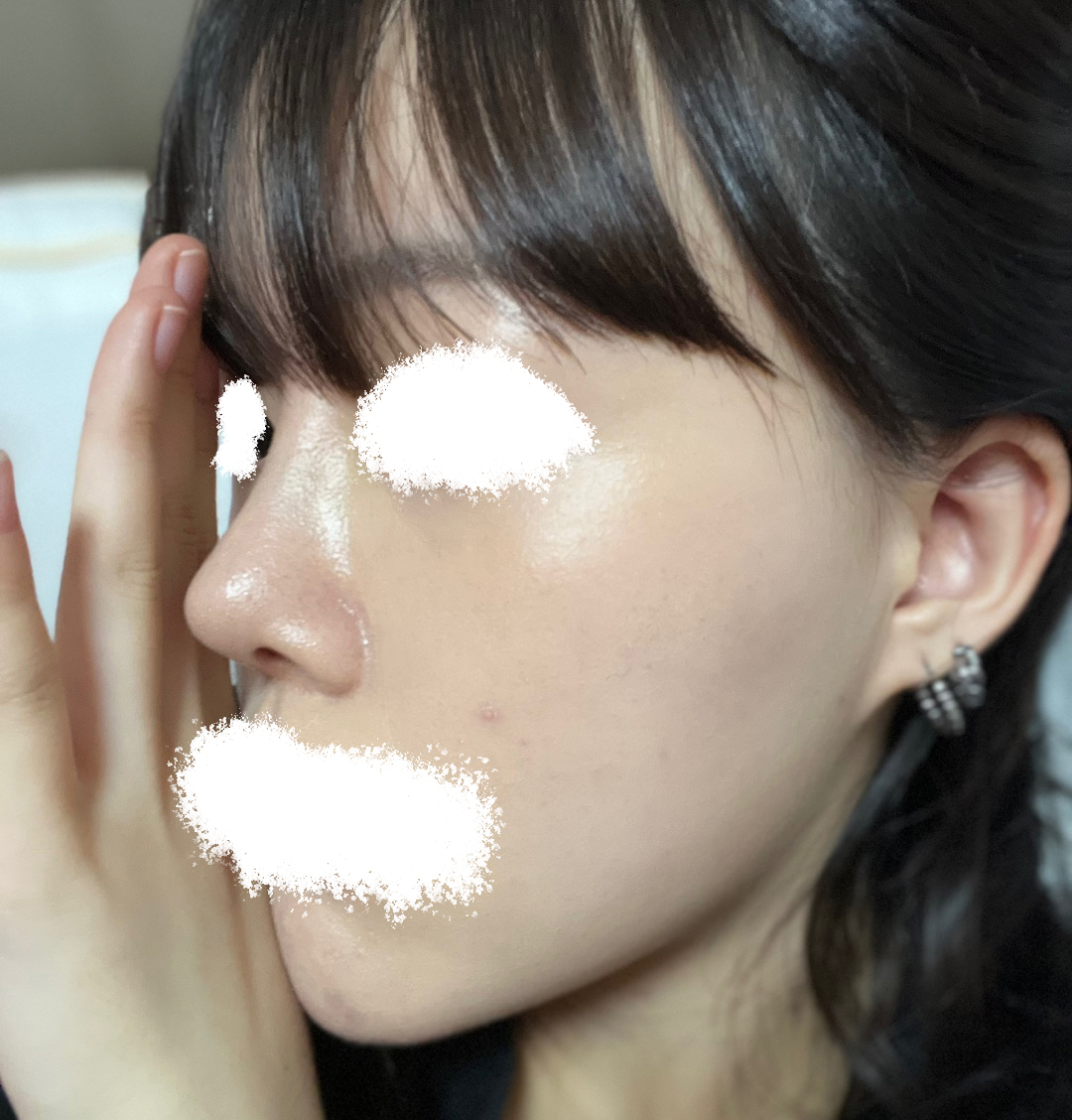 없던 콧대 만들어주셔서 감사합니다ㅠ_ㅠ