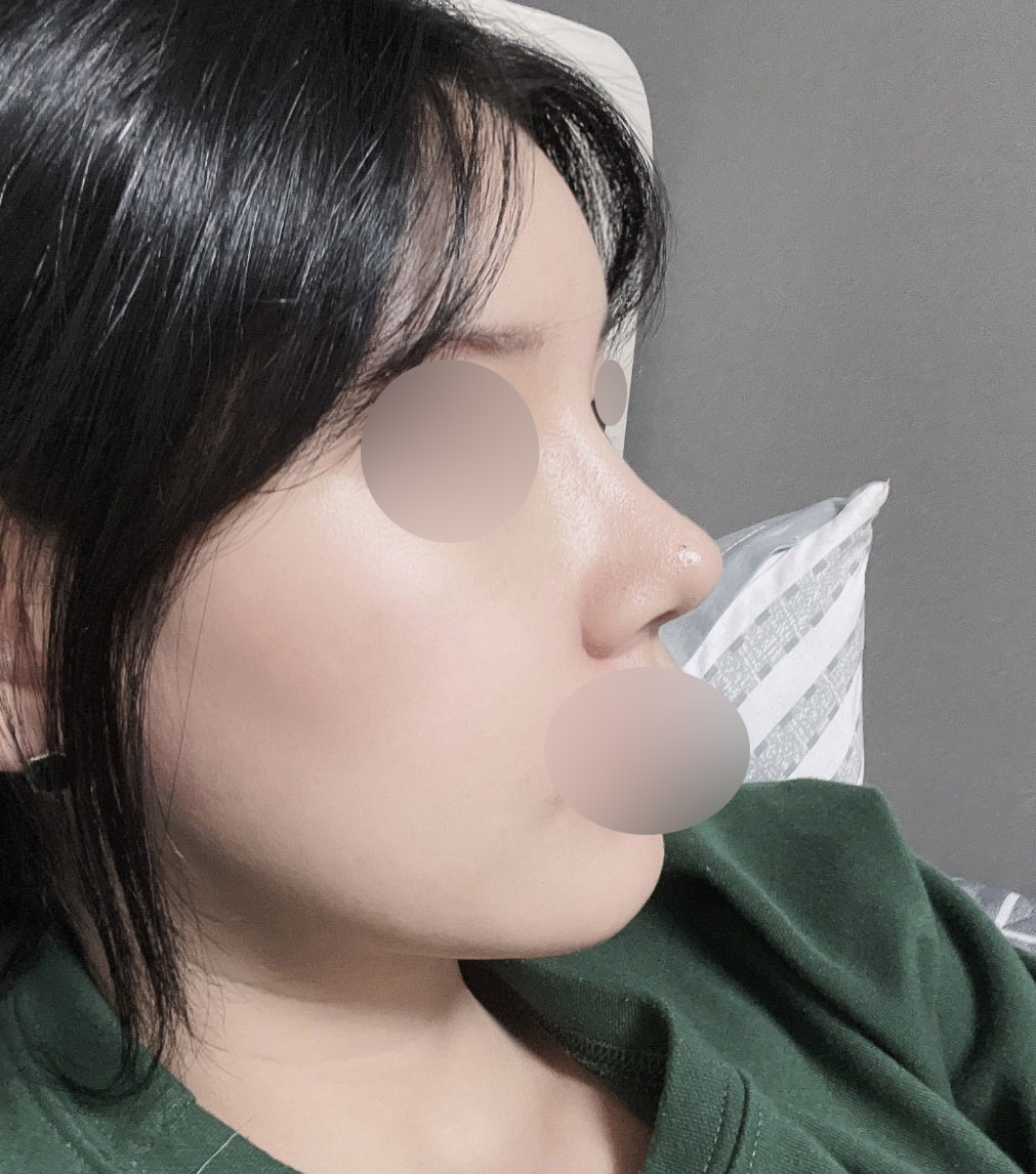 코,지이,지흡 한달차:)