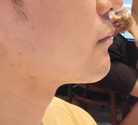 턱선이 제대로 달라졌어요 굿!