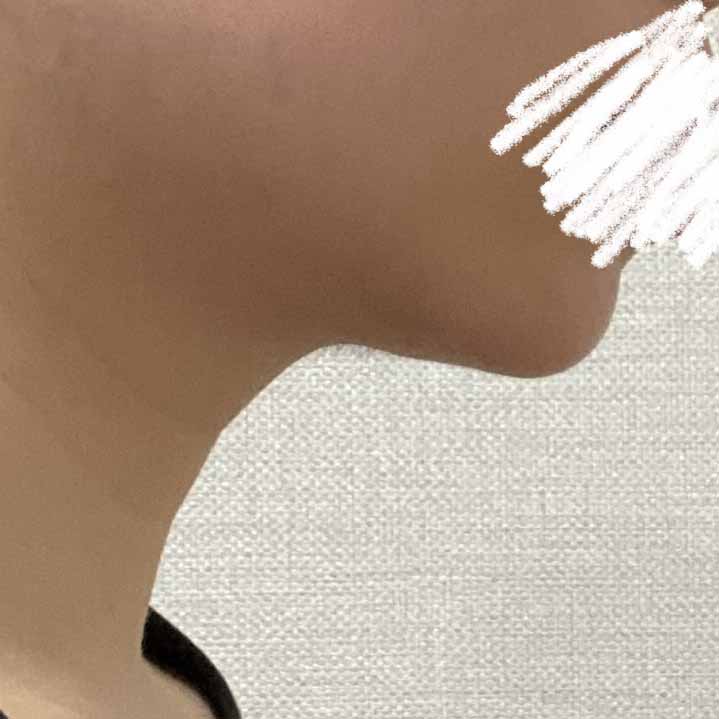 얼굴흡입 가성비 갑ㅋㅋ