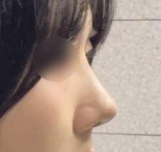 원하던 직반라인으롱!! 이쁘쥬?