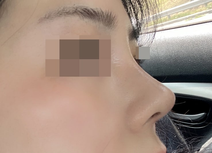 자연스럽고 화려한 코로 변신 ㅎㅎ