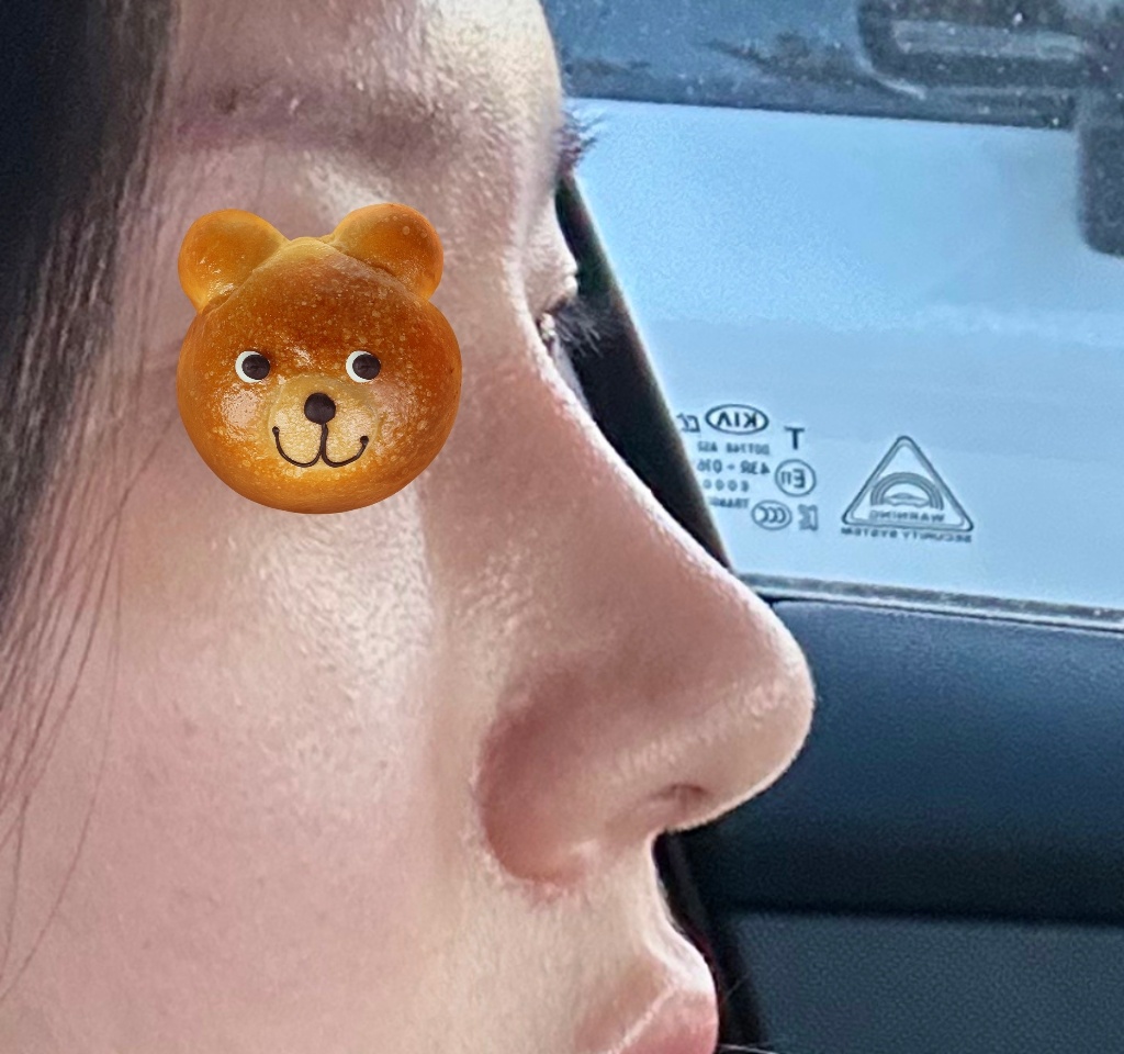 점점 원래 제 코처럼 자연스럽네요!!