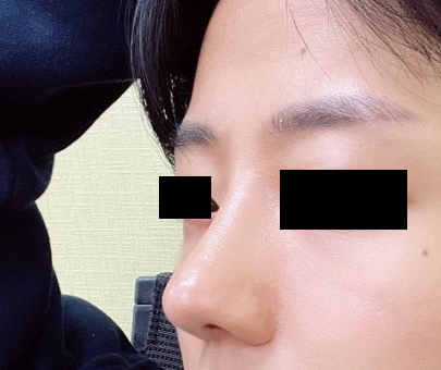 코하고 자신감 높아졌어요