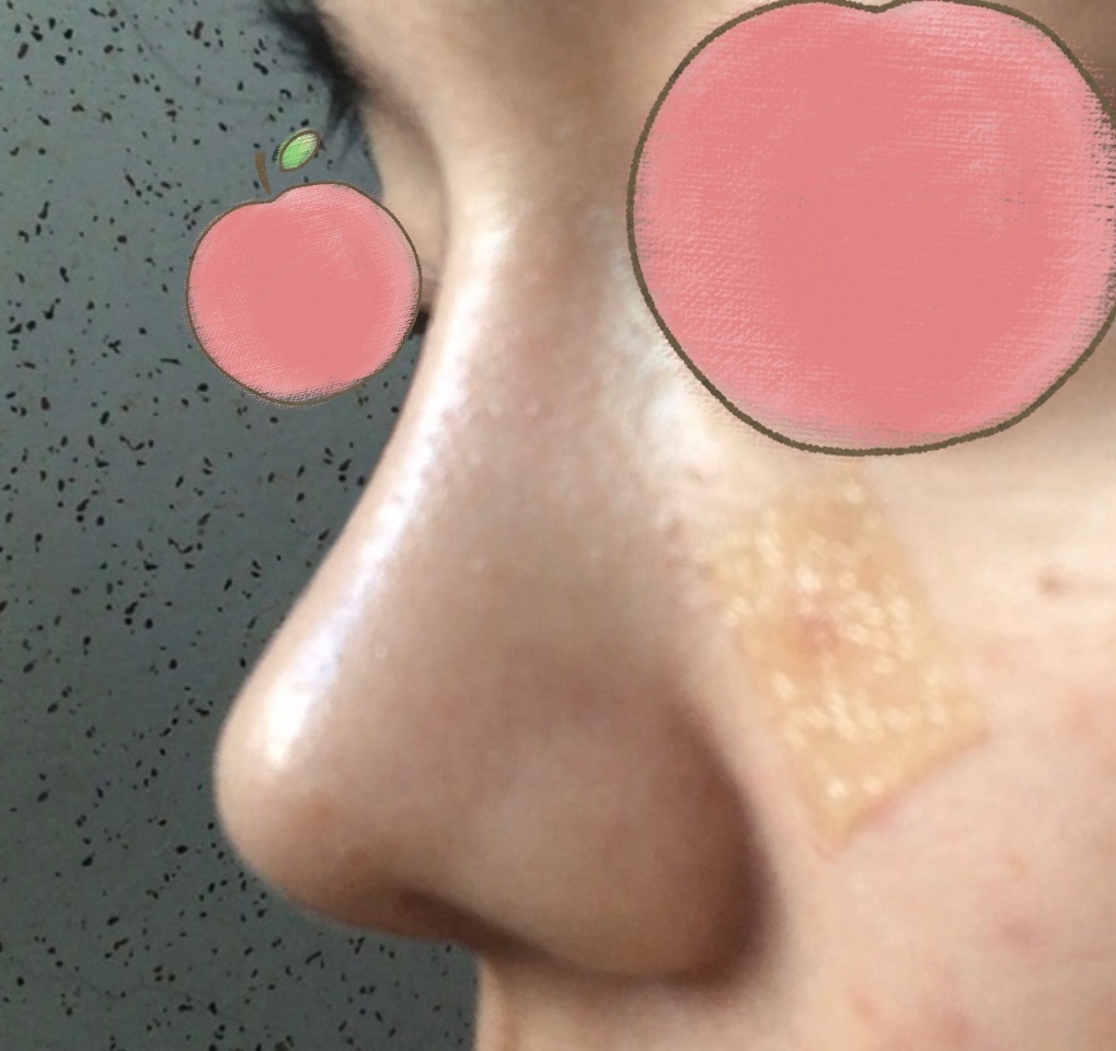 코재수술 잘된 덕분에 이미지도 달라졌습니당!