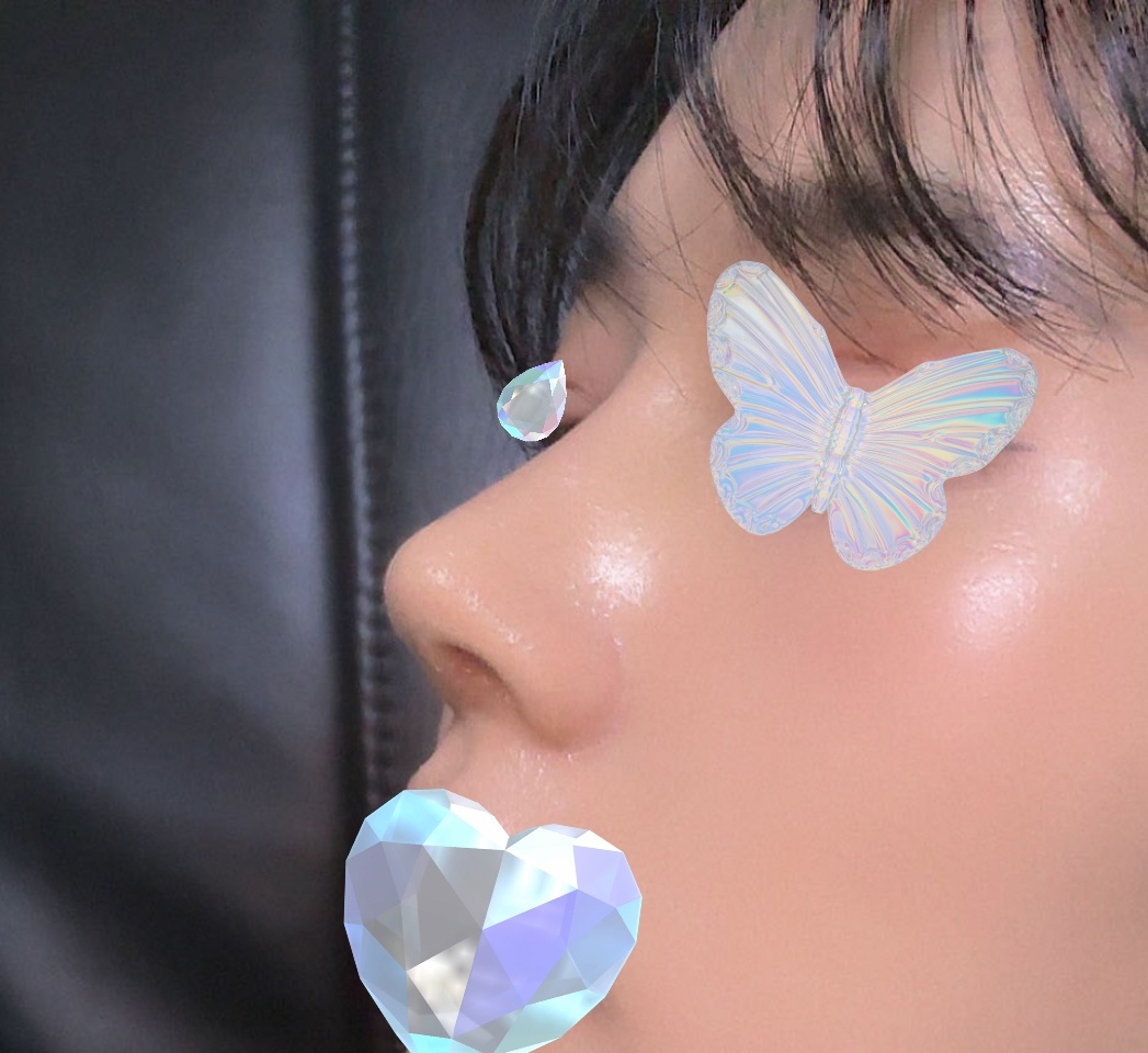 친구들이 제 코보고 수술하고싶다고하네용ㅎㅎ