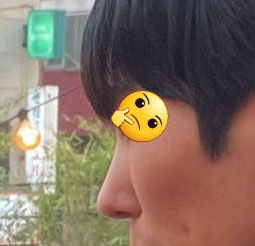 자연스럽게 잘 만들어주셨어요(코성형5개월차)