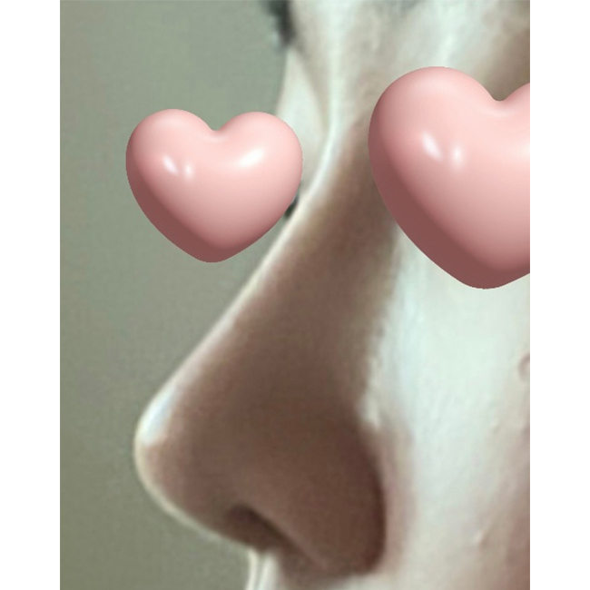 코수술한지 4개월됐네용