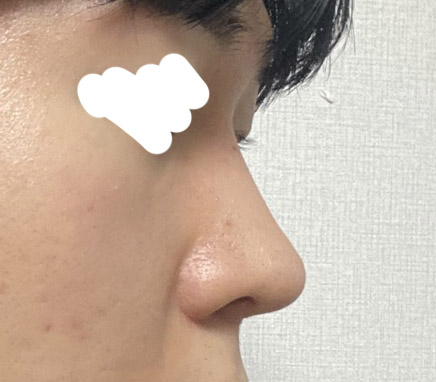 6개월됐는데 코모양 너무 맘에듭니다