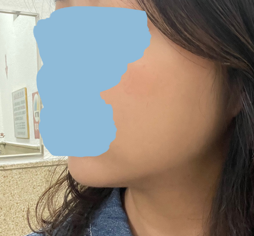 수술후_1_-1.jpg