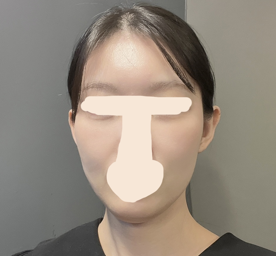 수술후_2_.jpg