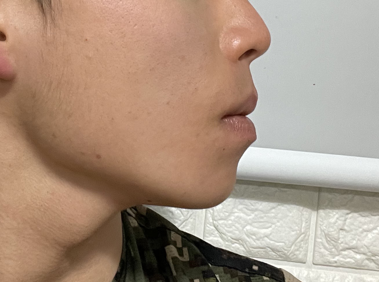 턱선이 날렵해졌습니다