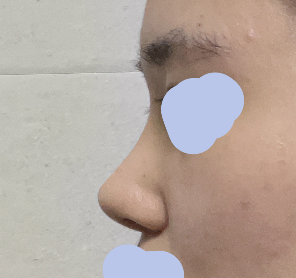 코 굉장히 만족스러워요^^
