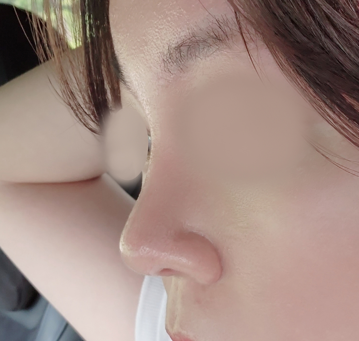 바이브 유영문원장님 수술 잘하세요 ^^!