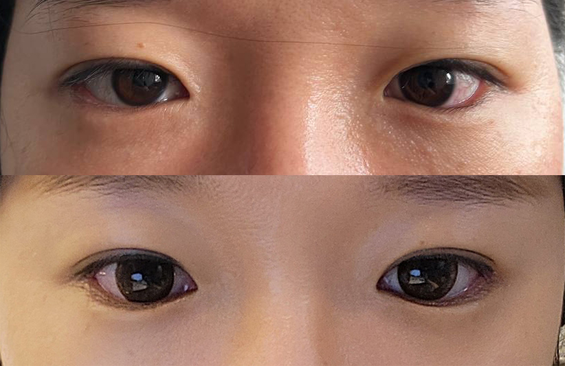 자연스럽게 잘 됐어요^^