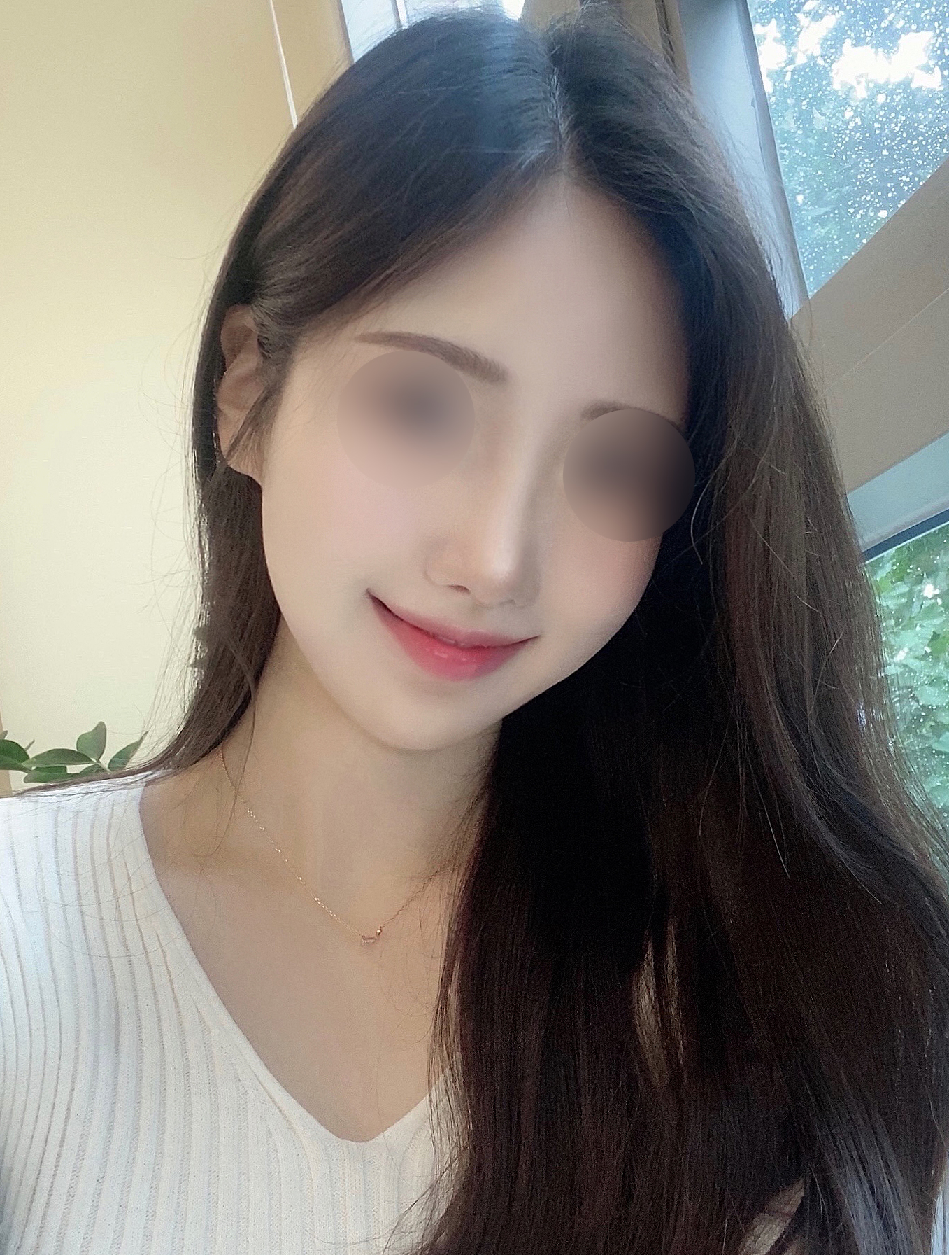 수술 안했으면 아쉬울뻔했어요ㅎㅎ