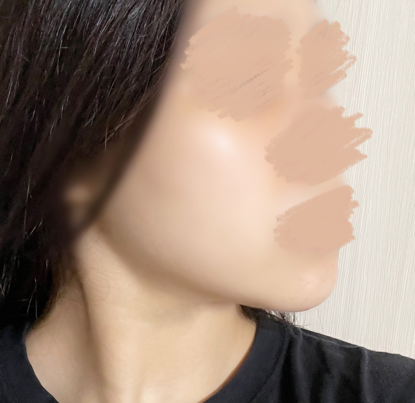 이중턱지흡 정말정말 추천드려욥!