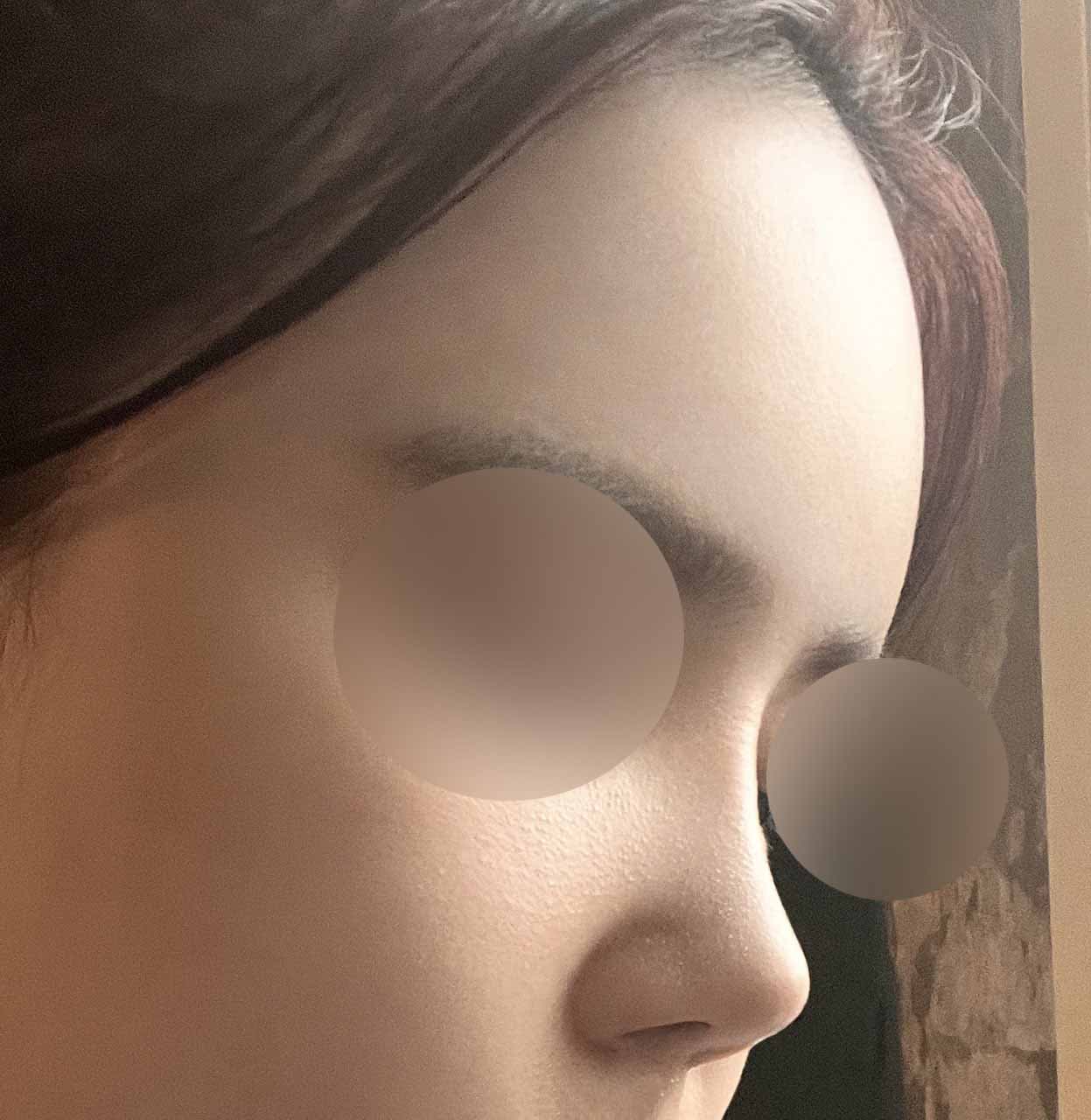 복코 탈출이요 ㅎㅎ