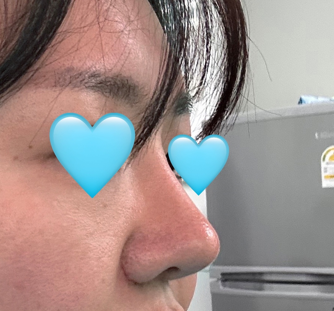 원장님이 자연스럽게 잘해주셨습니닷ㅎㅎ