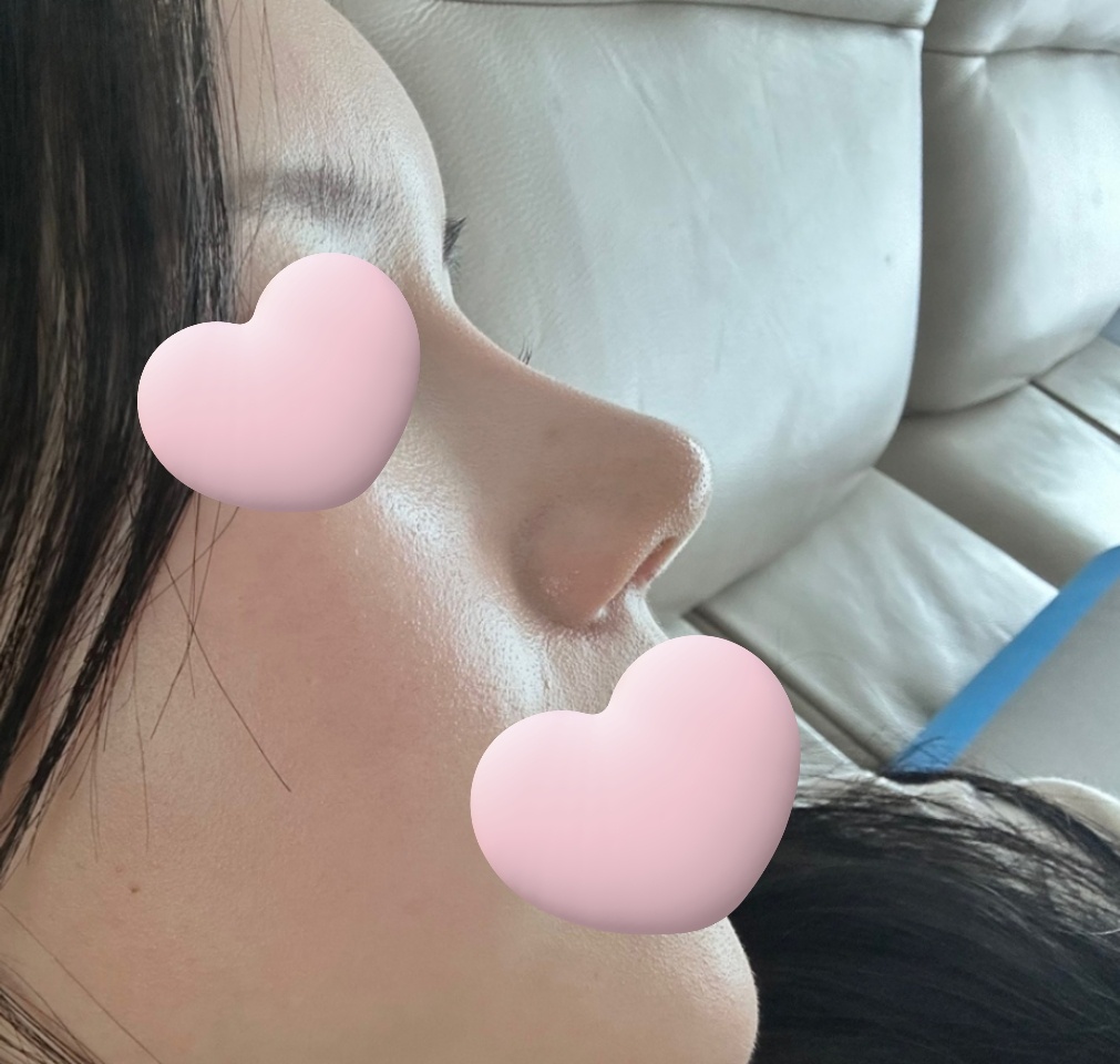 코성형3갤차!! 자리 잘 잡아가는둥~~