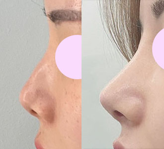 바이브에서 코 잘한거같아요^.^