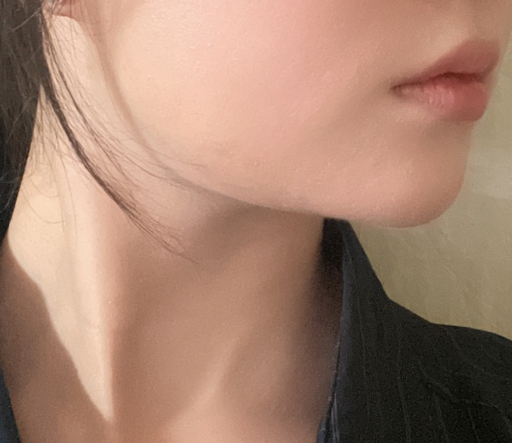 얼굴라인 예뻐졌어용!