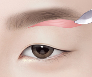 눈썹하거상술 Step 02