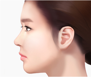 미니리프팅 Step 04