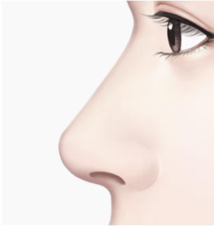 휜코 수술 Step 04